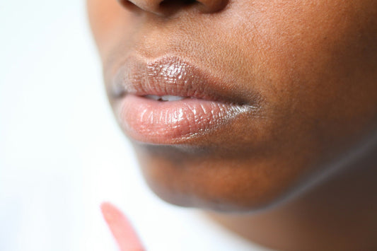 The Best Lip Balms for Dry, Chapped Lips (That Actually Work)