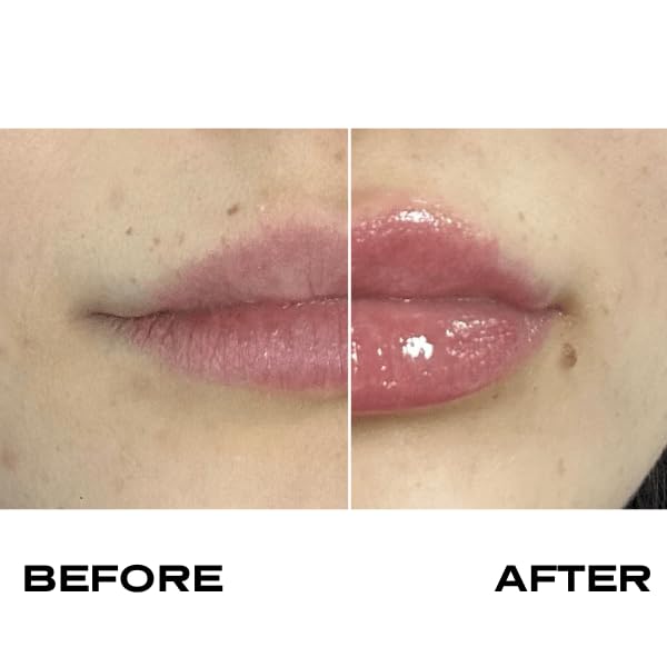 Plump It! | No Needles Lip Filler Kit: Extreme! | Instant Plumpers, Fuller and Softer Lips, Clear