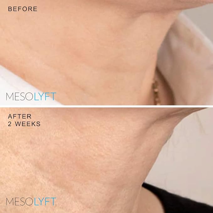 Neck & Lip Plumper Combo Plumping