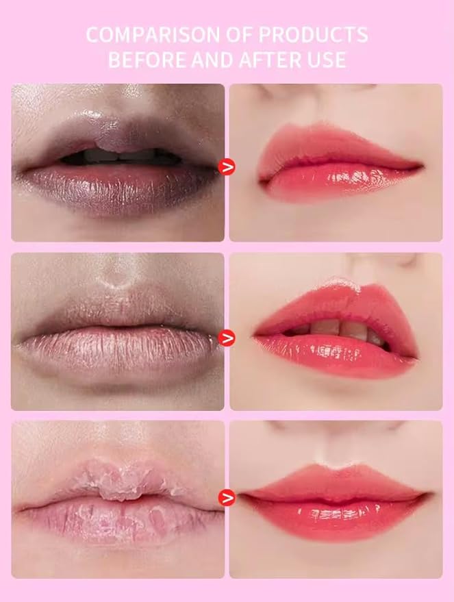 5-in-1 lip care kit, Lip scrub sleeping