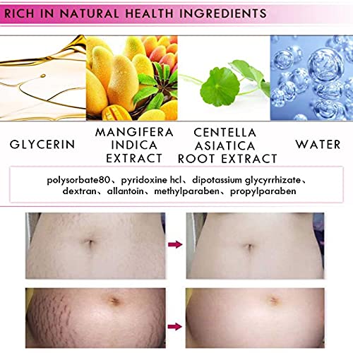 Mango Stretch Marks and Scar Cream,
