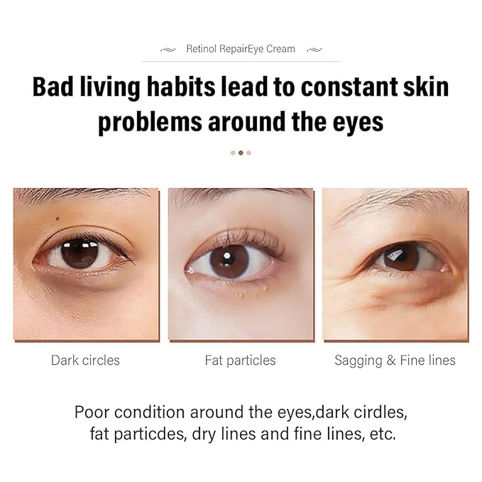Retinol Repair Eye Cream,Reduces the appearance of dark circles,Stretch wrinkles at the corners of the eyes,moisturize and improve eye bags,Suitable for all skin types,1.05oz(2pcs)