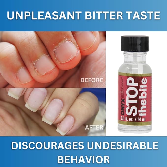 Onyx Professional "Stop The Bite"