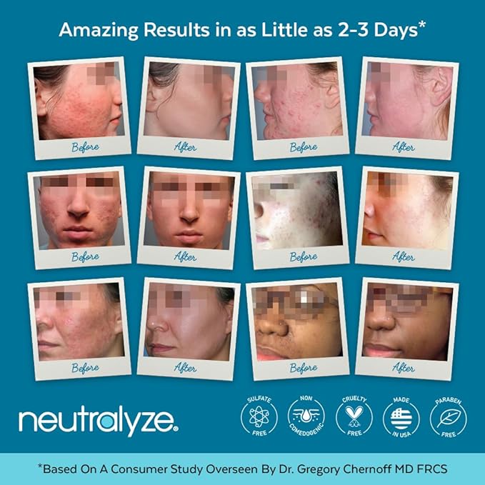 Moderate To Severe Acne Treatment Kit