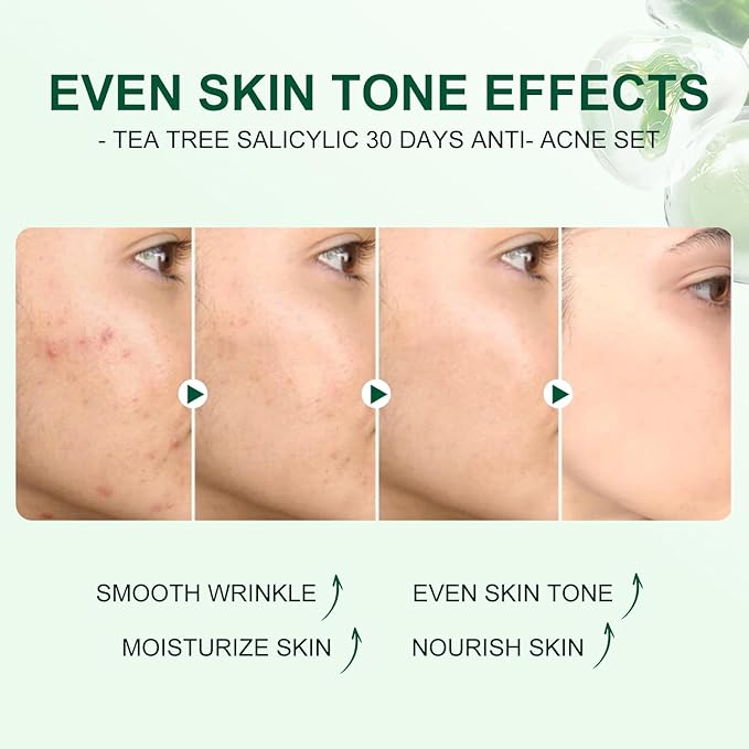 Skincare Mini Kit, Tea Tree Skin Care Sets & Kits, Acne Skincare Set Gifts, Anti Acne Facial Kit Gifts for Women,Cleanser, Toner, Serum, Cream,Oil Control Facial Kit, Airplane Friendly Sizes