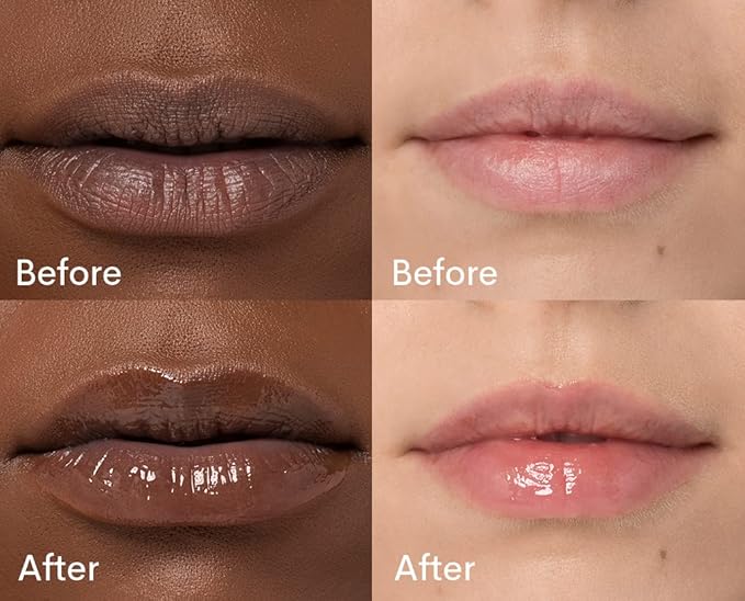 Peptide Lip Treatment with Anti-Aging Benefits oz)