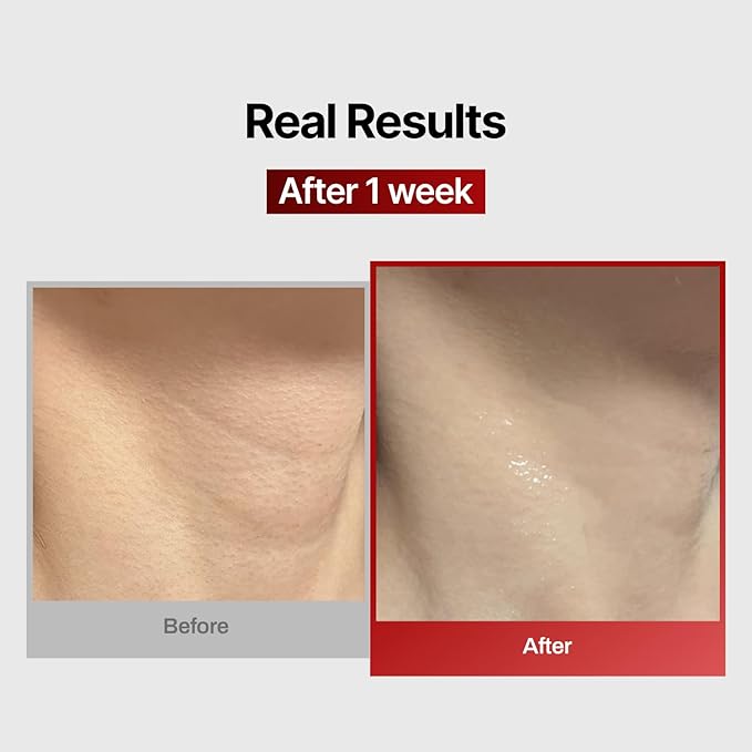 Wrinkle-fit Neck Mask 7EA + Boosting Roller - Neck Wrinkle Patches, Firming and Tightening Korean Deep Collagen Mask - NeckTargeted Mesh Sheet Mask and Face Roller for Lifting Sagging Skin