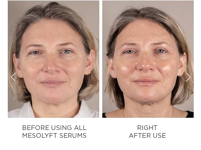 Power Combo Neck & eye Roller Brightening