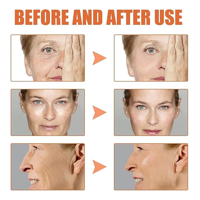 2pcs Face Serum, Stock Solution Facial Serum, in a Bottle, Instant Face Lift & Anti Aging Serum for Reduce Fine Lines, Wrinkles, Plump Skin