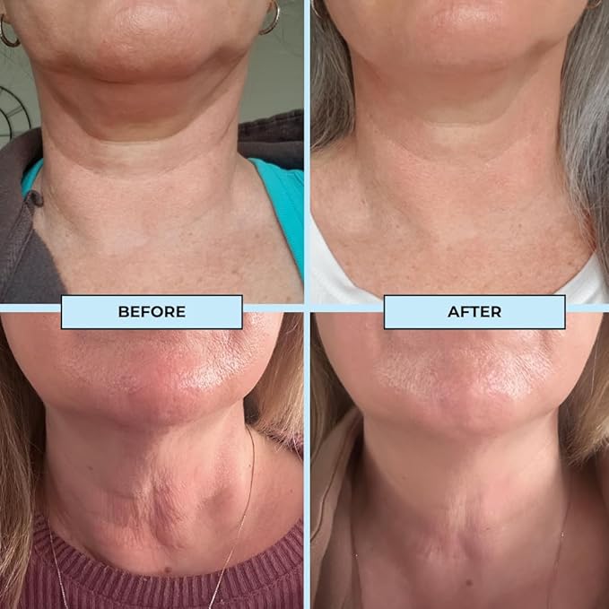 BOOST LAB Edelweiss Neck Firming Serum - Reduce Neck Wrinkles & Neck Ageing - Lifts & Smooths Crepe-Like, Sagging Skin - Paraben Free, Sulphate Free, Fragrance Free - 30 ml (1 fl oz)