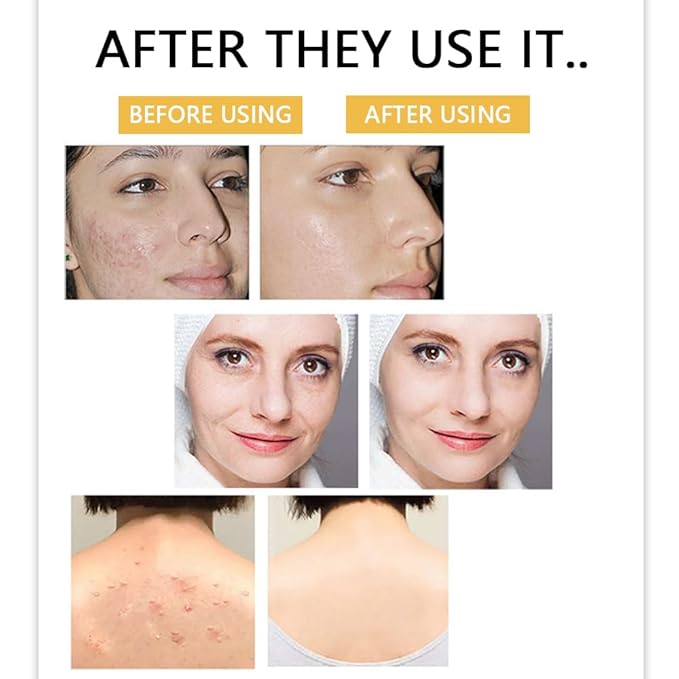 Kojic Acid Body Soap, Face &