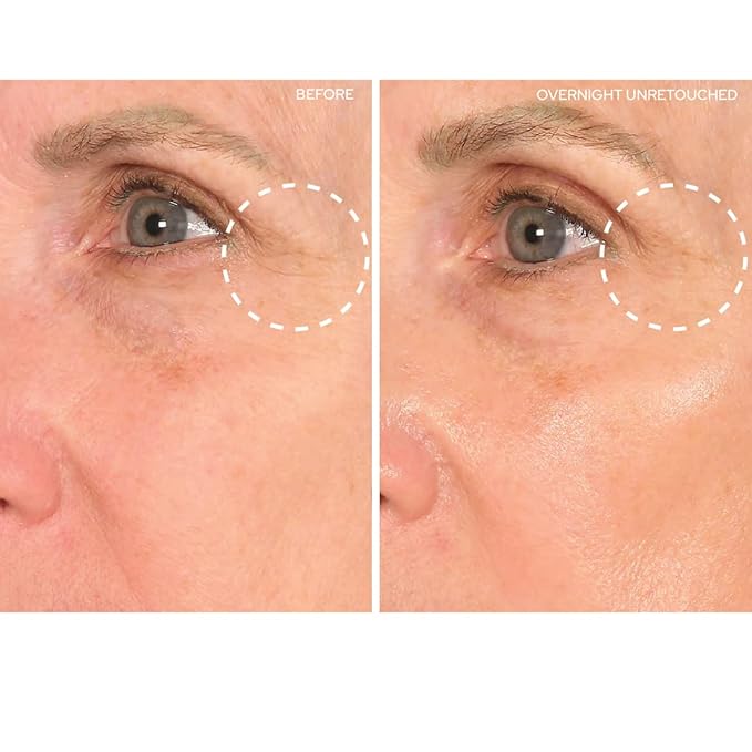 Sio beauty superlift forehead, eye,