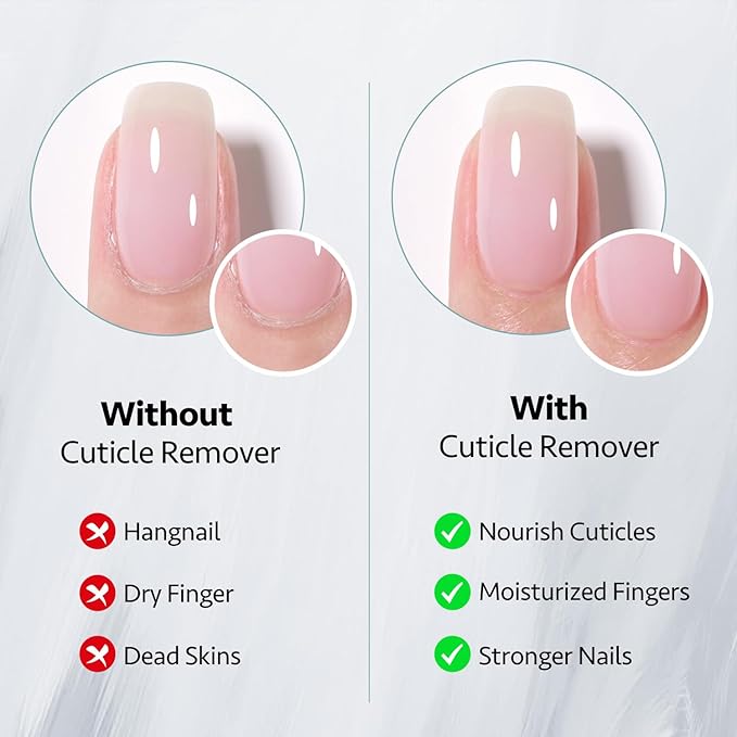GAOY 20ml Cuticle Remover Gel,
