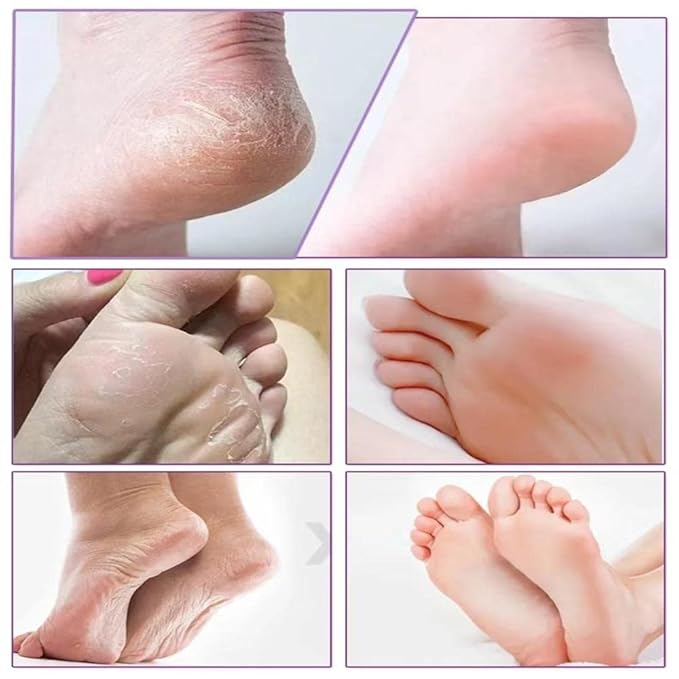 Foot Peel Mask 6 Pack,Foot Spa Foot Care For Women Peel Mask With Lavender For Men And Women Feet Peeling Mask Exfoliating, Callused Foot Mask Peel,Foot Mask For Dry Dead Skin,Remove Dead Skin