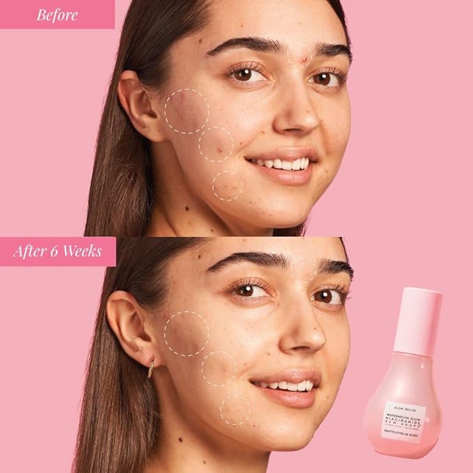 Glow Recipe Niacinamide Dew Drops Face Serum - Highlighting () 15ml