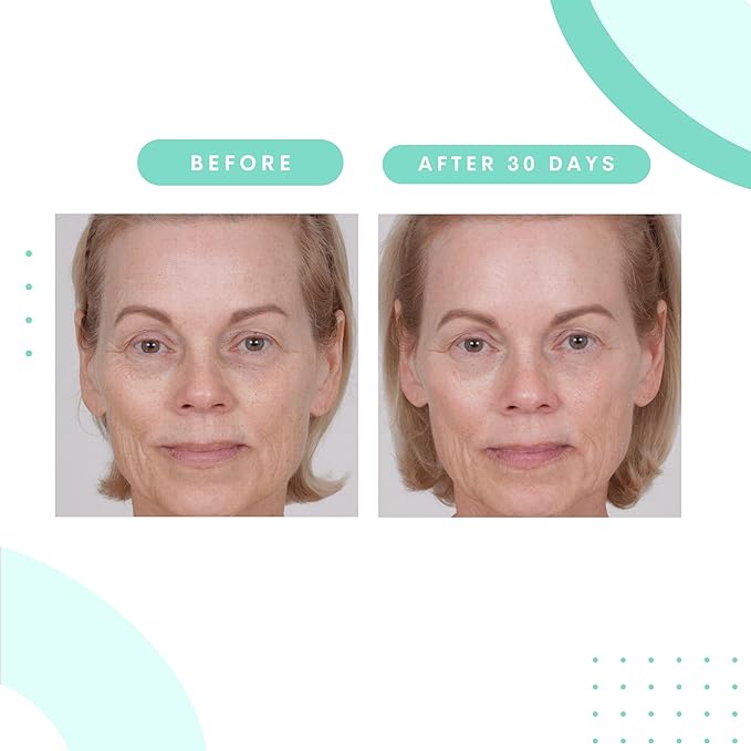 Serious Skincare Glycolic Acid Retexturizing Serum with Balancing Blue Tansy Extract - Diminish Lines & Wrinkles - Soften Rough Skin Texture - AHA - Anti-Aging Skin Treatment - 1 oz.