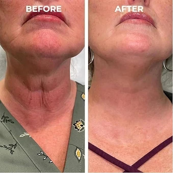 Fubsta Skin Firming Rejuvenating Serum, Firming Rejuvenating Serum for All Skin Types, Skin Firming Serum for Face And Neck (1Pcs)