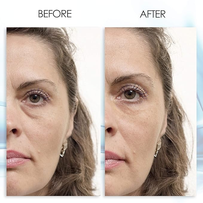 Puffy eye gel instant results