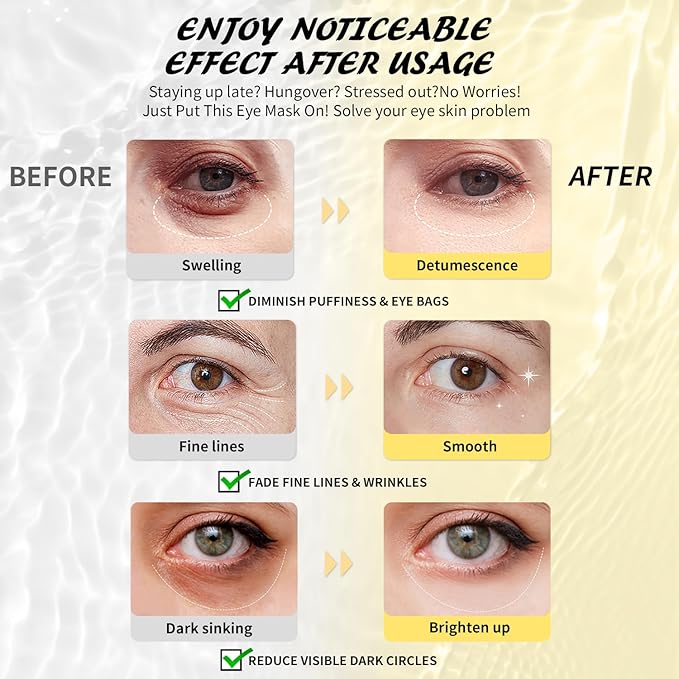 24k Gold Under Eye Patches & 3 in 1 Eye Masks Gift Set, Collagen Eye Patches for Dark Circles Undereye Bags Wrinkles and Puffiness, Eye Skin Care Gift for Her