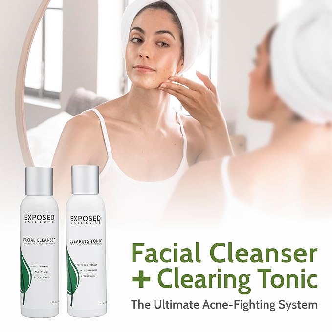 Exposed Skin Care Acne Treatment Kit Clearing