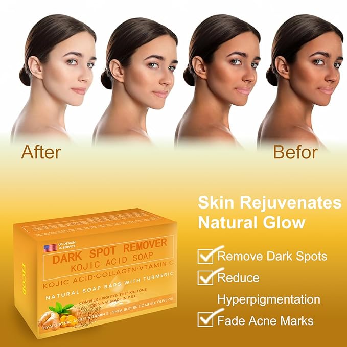 Kojic-Acid-Soap, 2Pack Turmeric Soap for Dark