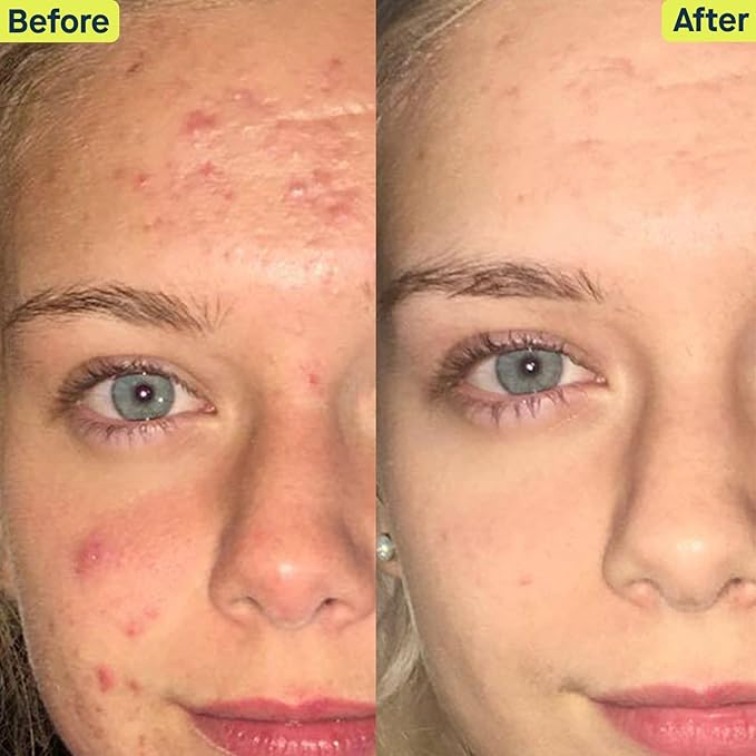 SLMD Skincare by Dr. Pimple Popper