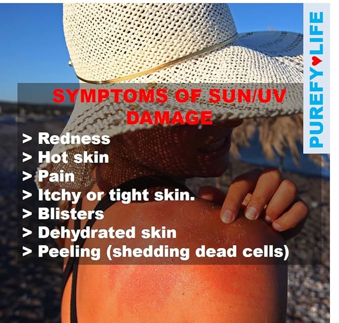 Sun and UV Recovery Spray