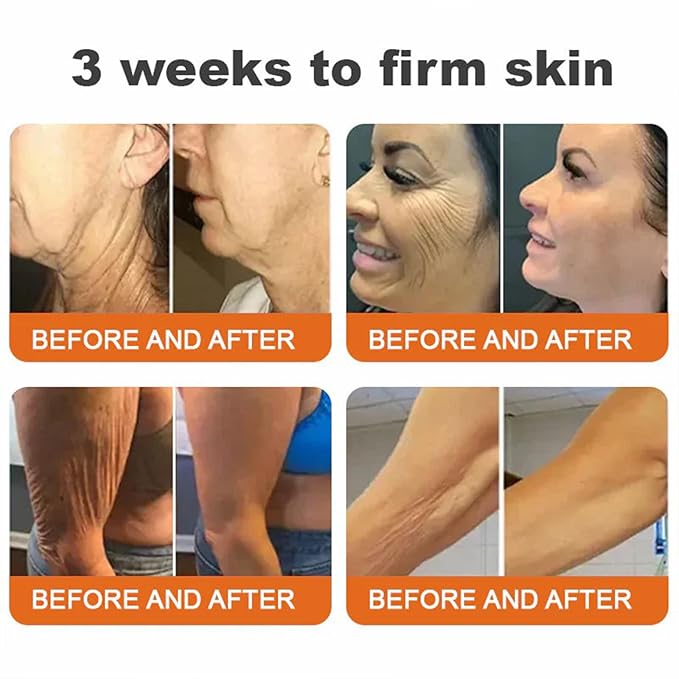 Botox Bee Venom Firming Serum Stick, Advanced Firming & Wrinkle-Reducing Cream, Bee Venom Wrinkle Remover Cream, Bee Venom Firming Serum Stick, Hydrates & Nourishes Skin (4PCS)