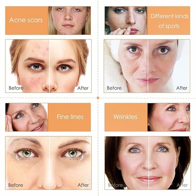 Skin Care Set ,Vitamin C Facial Aging