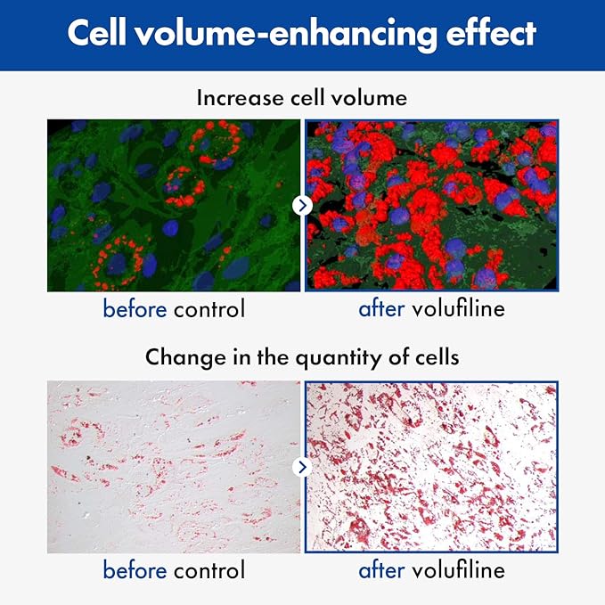 Volufiline Serum, 100% France Sederma Volufiline Concentrate for Plumping, Skin firming, Boost and Glass skin, glow Skincare for Face, lip and body, 11ml 0.37 fl. oz.