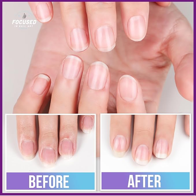 Teenitor Nail Files and Buffers,