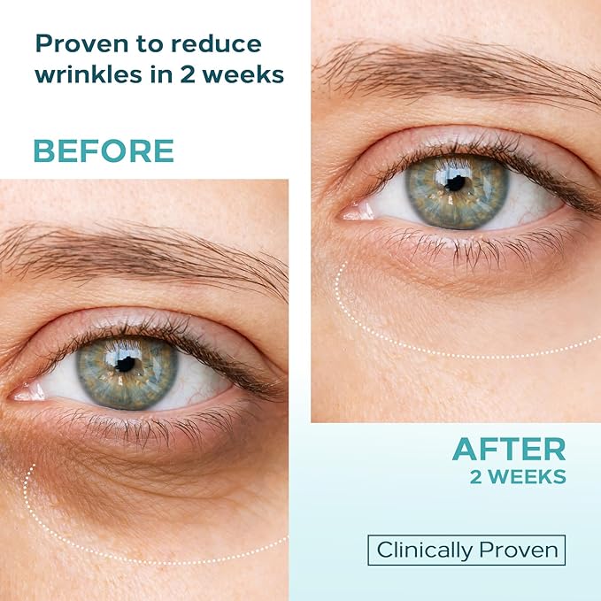 Eye Cream for Dark Circles & Puffiness – Dual Retinol + 5-Peptide Complex with Stem Cell Extract – Anti-Aging & Moisturizing – 0.68 OZ