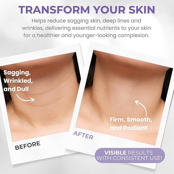 Neck Firming Cream - Lifts &
