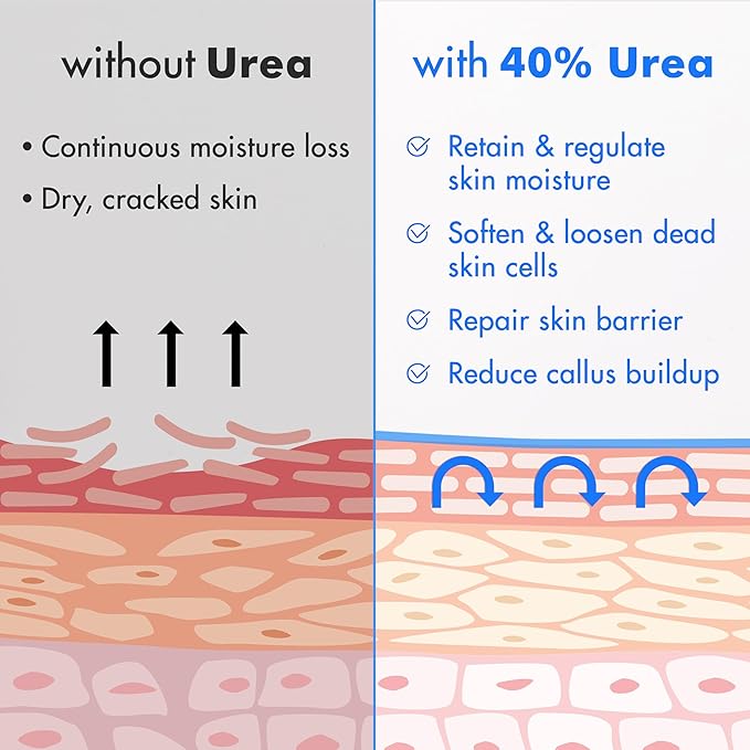 Ebanel Urea Cream 40% plus Salicylic Acid 2%, Foot Cream for Dry Cracked Heels Feet Knees Elbows Hands, Foot Dead Skin Cuticle Callus Remover Toenail Softener, Keratolytic Skin Barrier Repair, 2-Pack