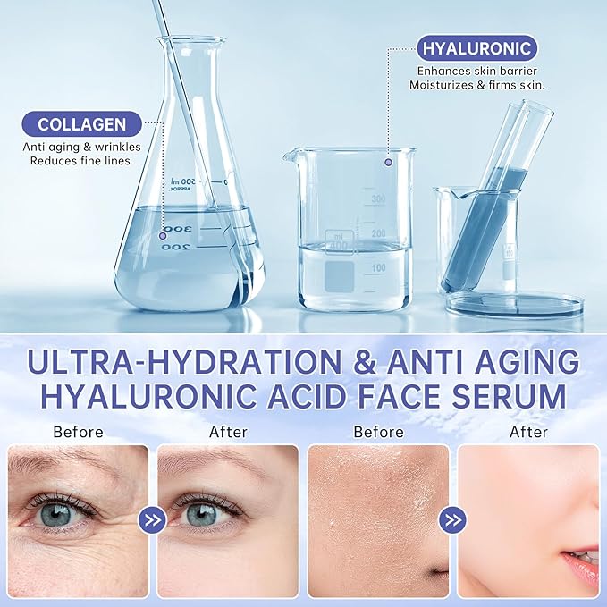 30 Pcs 5% Hyaluronic Acid Serum Ultra-Hydrating Vials, Hyaluronic Acid Tubes, Wake Nature Perfection Hylunaric Acid Serum, Single-Use Ultra-Hydrating Essence for Face