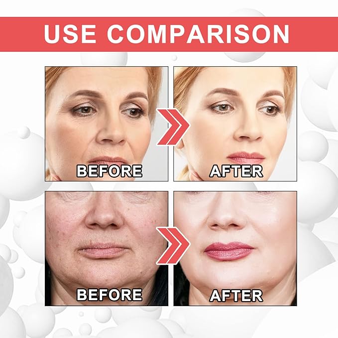 3Pcs EELHOE Collagen Boost Anti Aging Serum, EELHOE Collagen Anti-Wrinkle Cream, Voletas Collagen Boost Anti-Aging Serum