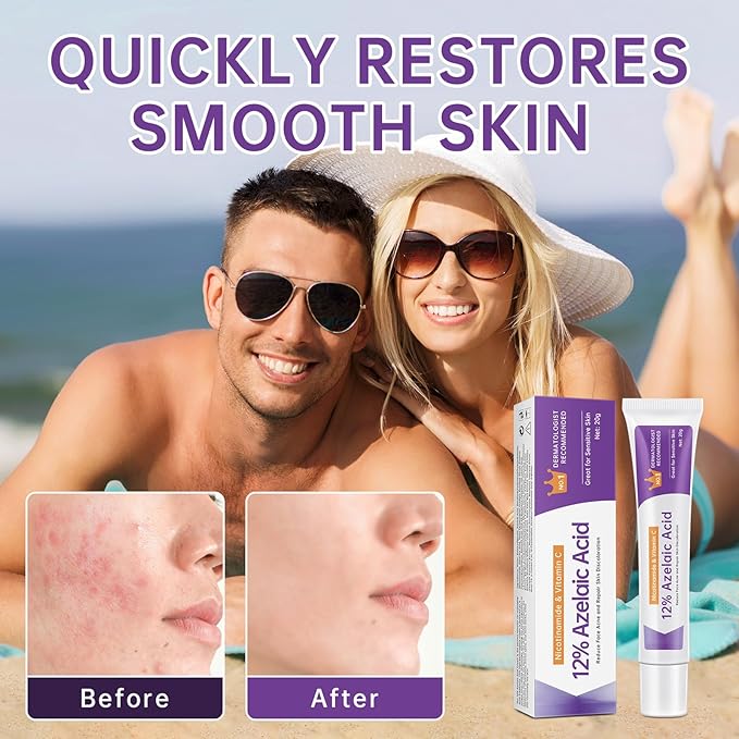 Azelaic Acid 12% Serum for Acne, Azelaic Acid Cream for Acne, blemishes and Pimples, Nicotinamide Serum Balances Excess Sebum for Smooth Skin, 0.7 OZ