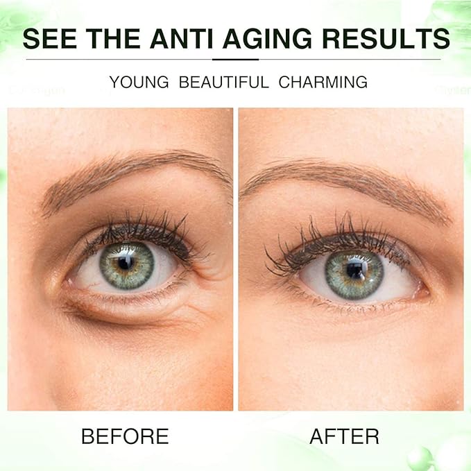 Under eye mask, collagen eye
