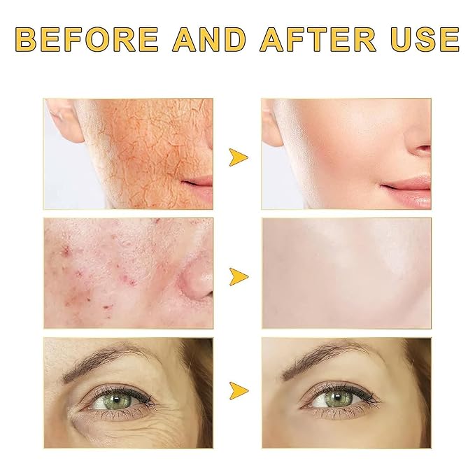 Advanced Snail Mucin 96% Power Repairing Essence, Snail Mucin 96% - Anti-Aging Serum, With Snail Secretion Filtrate For Dull (01)