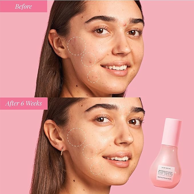 Glow Recipe Watermelon Glow Niacinamide Dew Drops Face Serums () 40ml