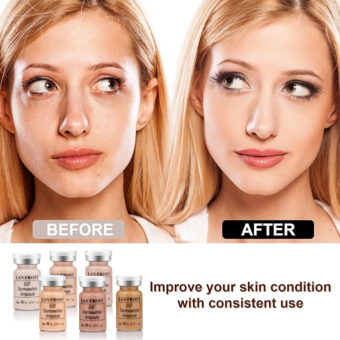 BB Glow Starter Kit Hyaluronic Acid Serum Foundation Kit (Multicolor) 27oz