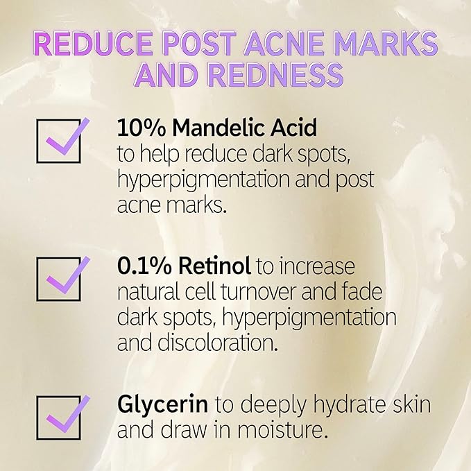 The INKEY List Mandelic Acid Treatment, .5 fl oz