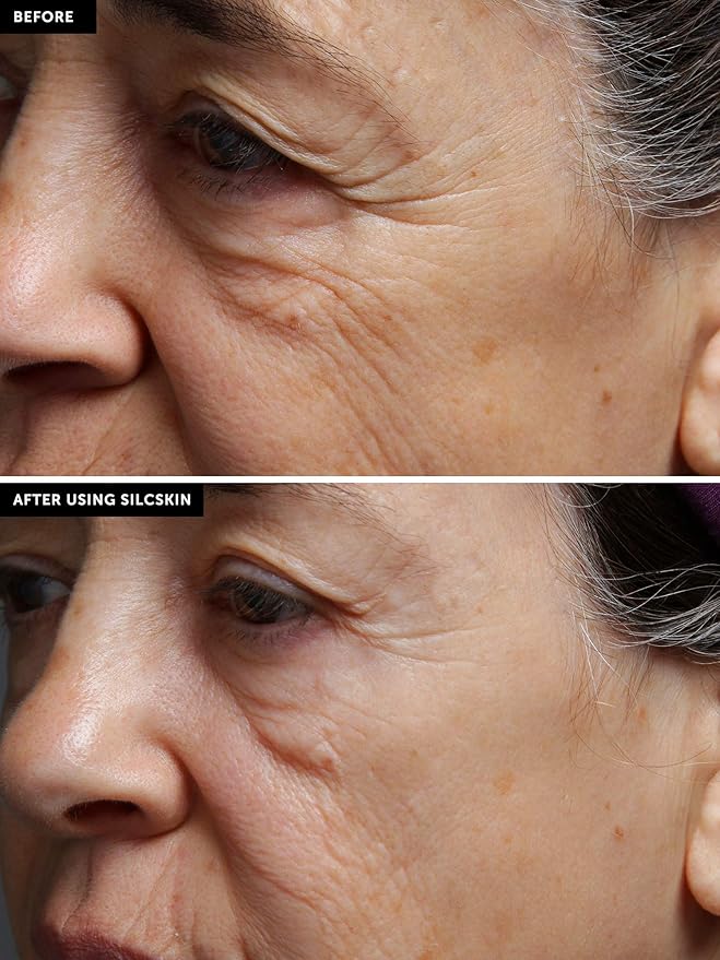 SilcSkin Full Face Set, Helps