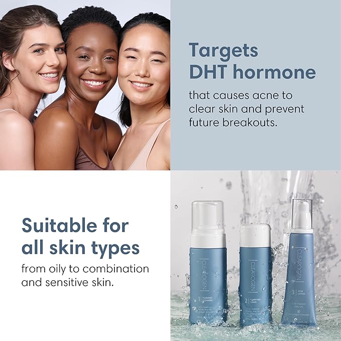 Acne Treatment Kit, Acne Kit, Skin