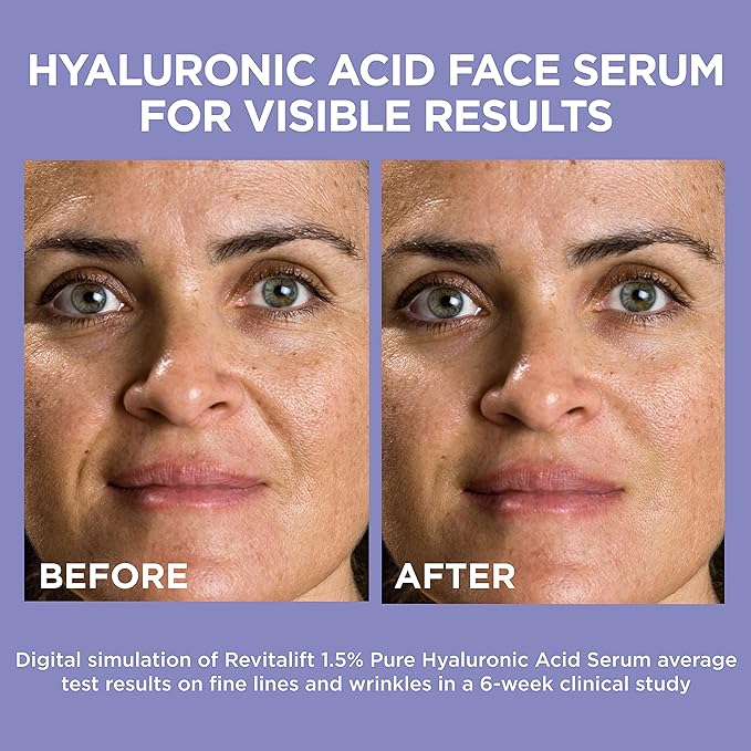 L'Oreal Paris Revitalift 1.5% Pure Hyaluronic Acid Face 1 kit 1.0 oz