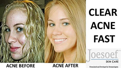 JOESOEF SKIN CARE Sulfur Soap