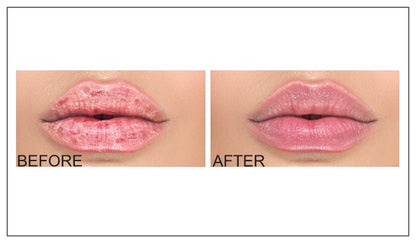Lip Balm Moisturizer by Sherrin Rosette. Stocking