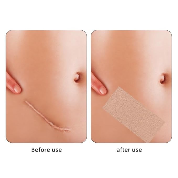 Tattoo Cover up Patch, Waterproof Sweatproof Sticker Patch, of 1)
