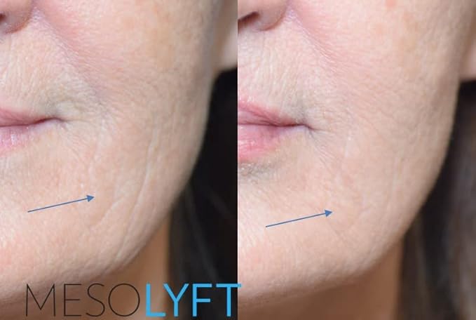 Power Combo Neck & eye Roller Brightening