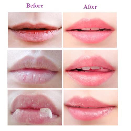 2PCS Lip Balm Honey Pot,Honey &